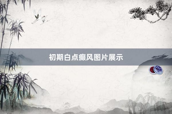 初期白点癫风图片展示